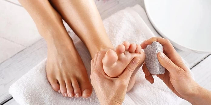 Κάλοι στα πόδια;-Τι να προσέξετε κατά την αφαίρεσή τους!